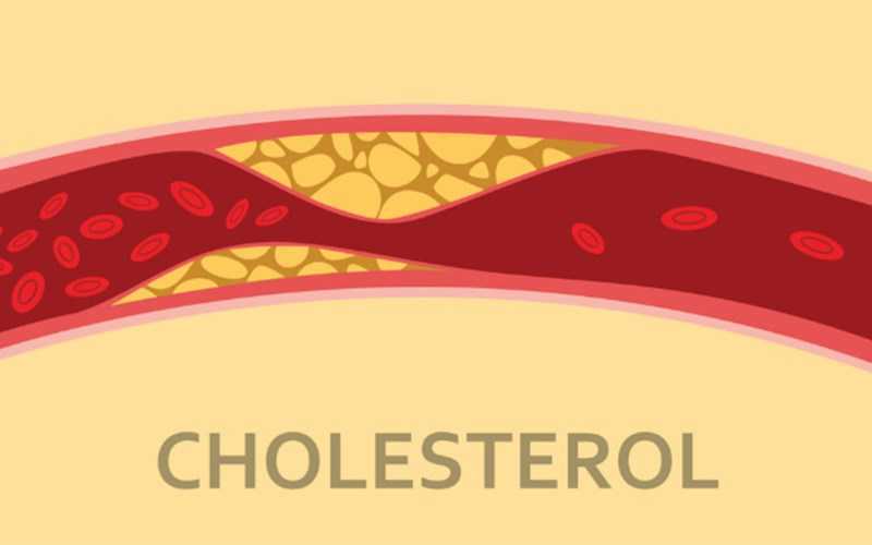 Giáº£m lÆ°á»£ng cholesterol trong mÃ¡u